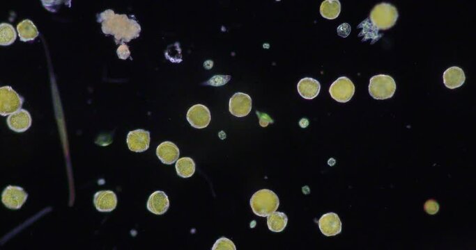 Glenodinium sp.under the microscope for education.

