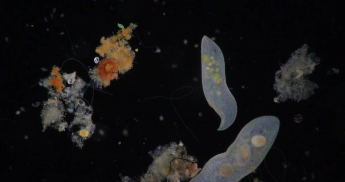 Loxodes is a genus of karyorelictean ciliates, belonging to family Loxodidae under the microscope for education.
