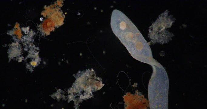 Loxodes is a genus of karyorelictean ciliates, belonging to family Loxodidae under the microscope for education.
