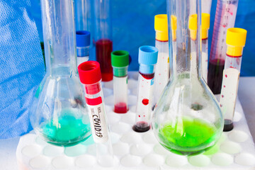 Covid - 19 and corona virus blood test, negative and positive tests, reagents and glassware