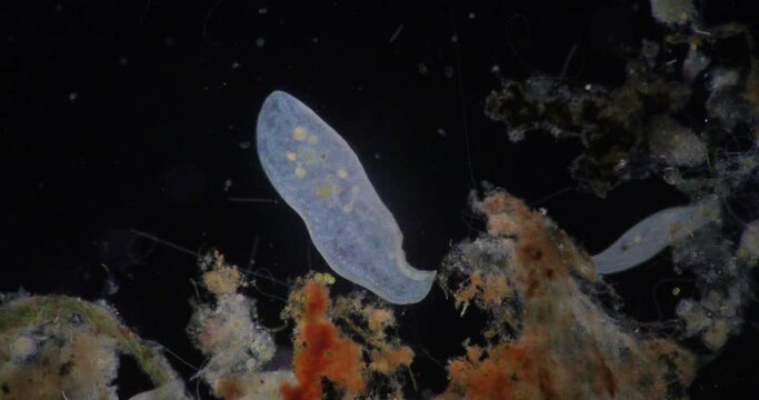 Loxodes is a genus of karyorelictean ciliates, belonging to family Loxodidae under the microscope for education.
