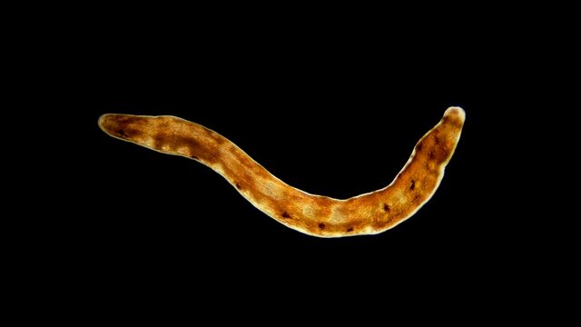 Nemertea worm under a microscope, supertype Spiralia. Highest classification: Lophotrochozoa, specimen found in the Black Sea