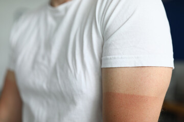 Person after taking sunbath