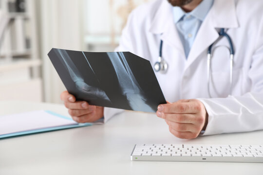 Orthopedist examining X-ray picture at desk in office, closeup