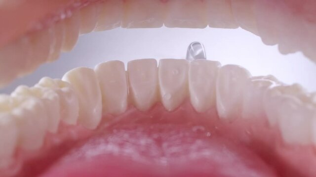 Water flosser cleaning teeth on white background. View inside of mouth, open jaw. Teeth cleaning with oral irrigator. 4k 120 fps