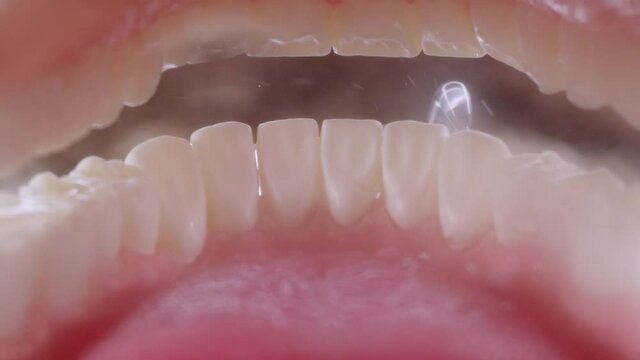 Water flosser cleaning teeth on black background. View inside of mouth, open jaw. Teeth cleaning with oral irrigator. 4k 120 fps