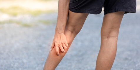 Young woman suffering from calf pain health care concept © anut21ng Stock
