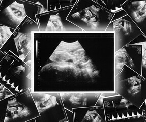 ultrasound picture of a child