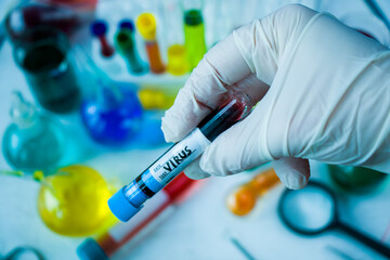 virus blood test tube in laboratory, glassware and reagents