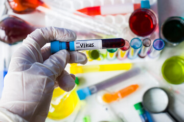 virus blood test tube in laboratory, glassware and reagents