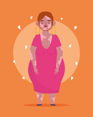 perfectly imperfect, plus size cartoon woman with vitiligo