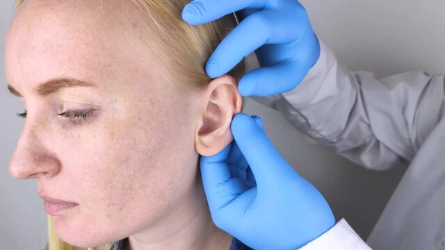 A plastic surgeon examines a patient's auricle. The doctor sees a tubercle on the curl of the ear.