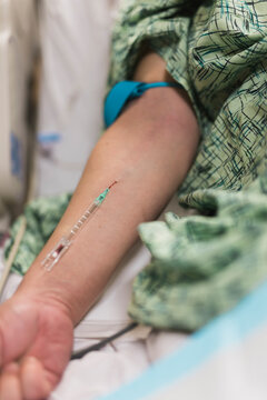 Failed IV Insertion