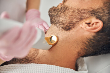 Bearded young man undergoing laser hair removal procedure