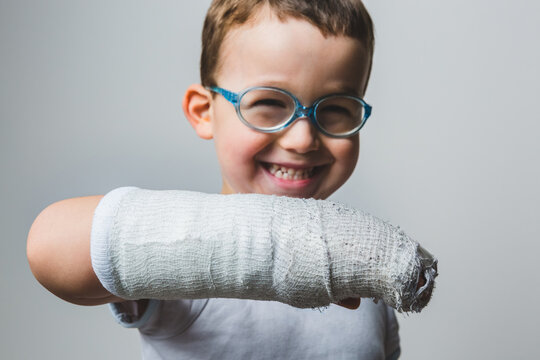 Smiling Kid Showing the Arm Cast