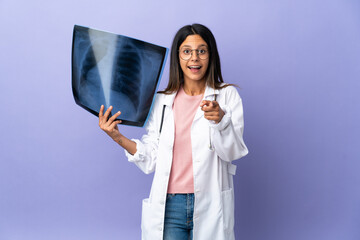 Young doctor woman holding a radiography surprised and pointing front