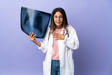 Young doctor woman holding a radiography surprised and shocked while looking right