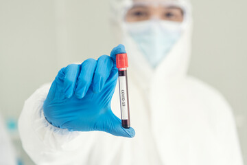 Scientist covid-19 virus chemistry  research experiment biotech antibody sample laboratory...