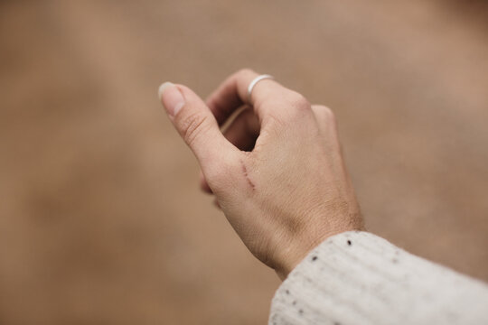 hand with cut on thumb