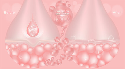Hyaluronic acid before and after skin solutions ad, pink collagen serum drop with cosmetic advertising background ready to use, illustration vector.