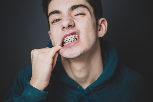 Portrait of a teenager with braces