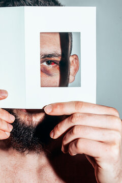 eye,bruising,hide,beard