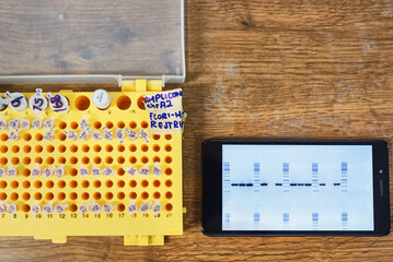 Cellphone with DNA sequence and test tubes in a genetic lab