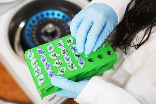 DNA researcher loading biological sample in centrifuge machine - Powered by Adobe