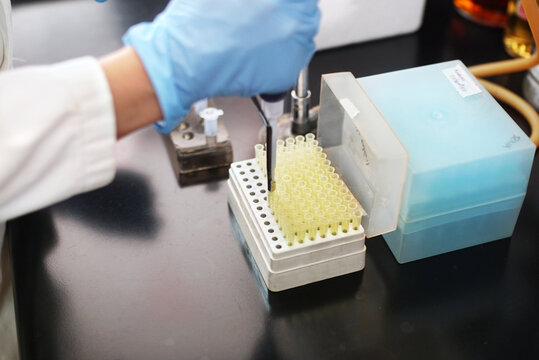 Lab professional using micropipette