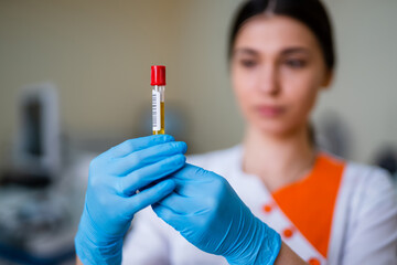 Testing in laboratory. Chemical research. Medicine dropper with blood.