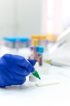 Helicobacter pylori rapid test performed in a lab