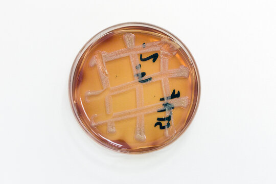 Staphylococcus colony on a petri dish on a white background in the lab