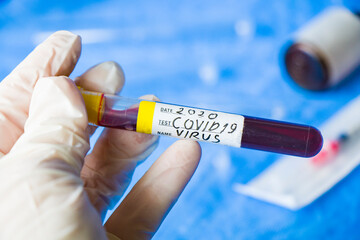 Obraz premium Corona virus negative test samples. Diagnosis and laboratory. Studio shoot, white background.