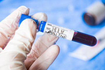 Fototapeta premium Hiv and aids infection test, hand holding tube with blood on the blue background.
