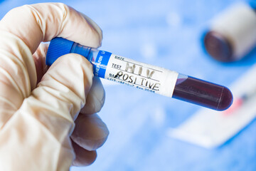 Obraz premium Hiv and aids infection test, hand holding tube with blood on the blue background.