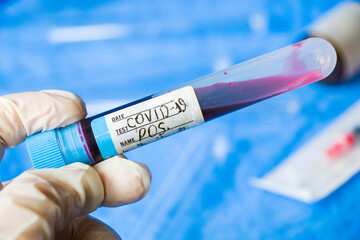 Obraz premium Corona virus positive test samples. Diagnosis and laboratory. Studio shoot, white background.