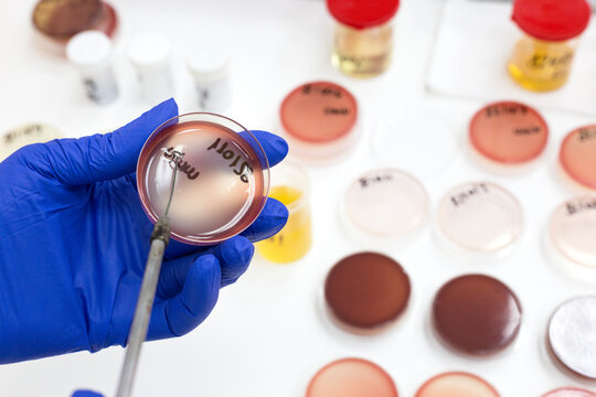 Lab technician putting a sample on an agar plate for testing