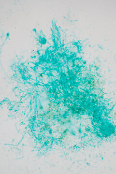 penicilium fungi