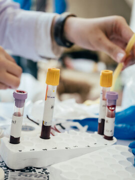 medical blood test tubes