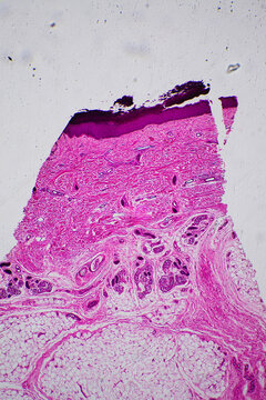 Thick layer cells of human skin