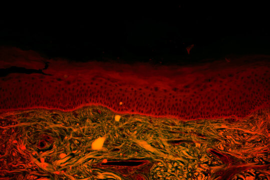 Thick layer cells of human skin