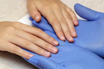 Fototapeta premium Child's hands with very short damaged nails. Hygienic medical manicure for children. 