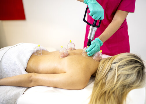 View of a young woman getting a  ventosa massage in a spa salon