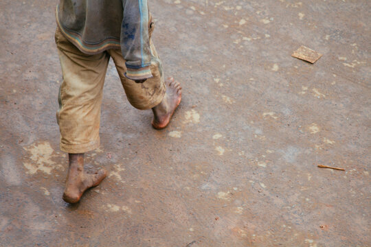 Detail of poor boy bare feet walking on the street