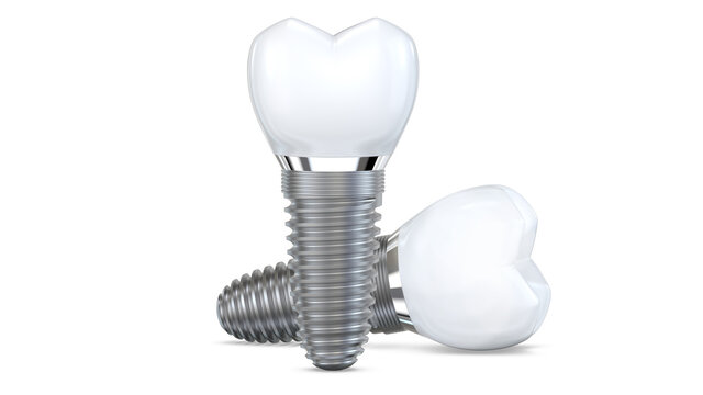 Two dental implant model of molar tooth as a concept of implantation teeth and dental surgery. 3d rendering illustration isolated on white background