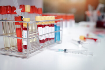 Blood samples in tubes and syringes on work table in a medical examination lab.