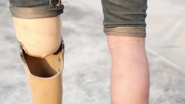 Slow motion of a poor disabled man  wearing a left prosthetic leg and a disabled left arm walking on the sidewalk on the roadside.