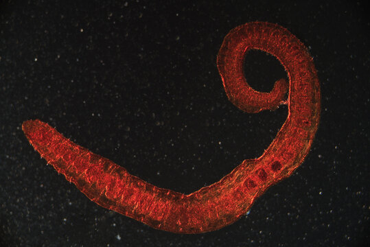 worm larva, micrograph.