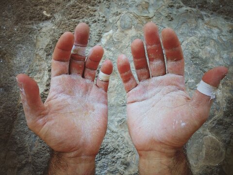 worn hands of a rock climber