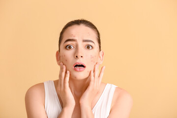Stressed young woman with acne problem on color background